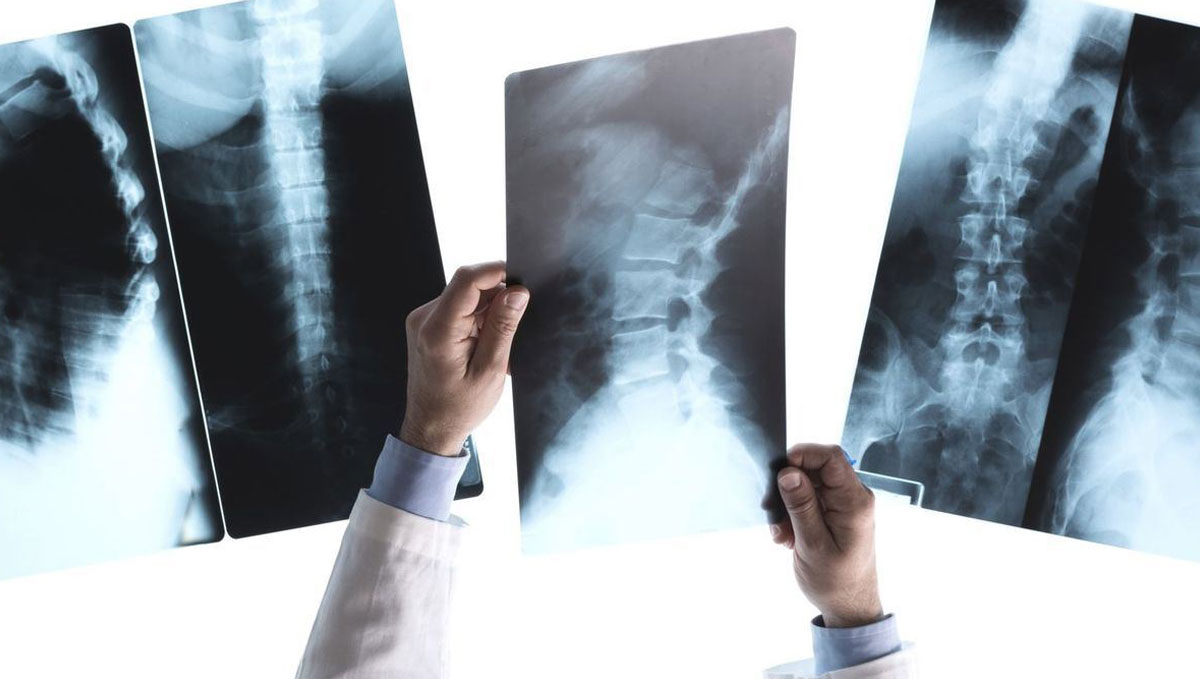 Imagerie Médicale (IM)